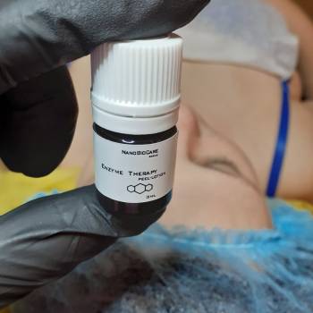 Ферментотерапия лица