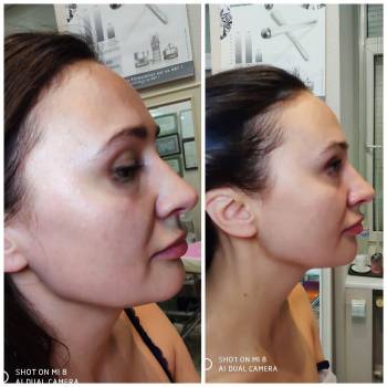 Буквальный массаж 