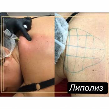 Фото с портфолио Юлия Баркова 