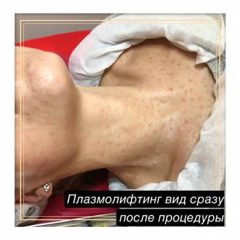 Фото с портфолио Юлия Баркова 