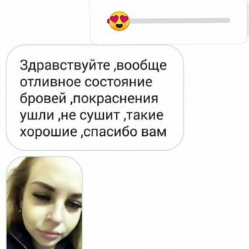 Artem Kokhanevich, Дніпро Фото - 7