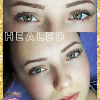 Зажившие бровки 