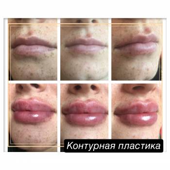 Фото с портфолио Юлия Баркова 