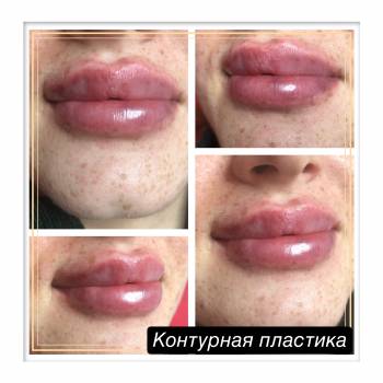 Фото с портфолио Юлия Баркова 