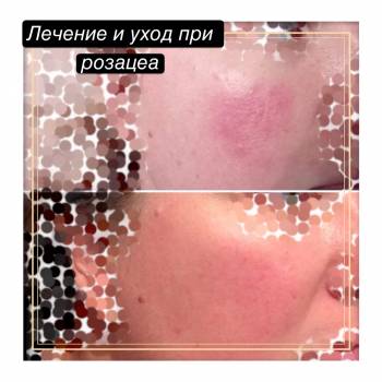 Фото с портфолио Юлия Баркова 