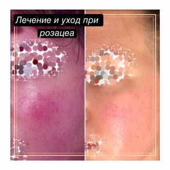 Фото с портфолио Юлия Баркова 