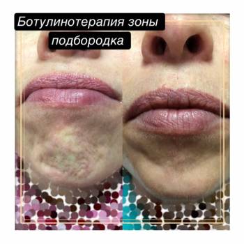 Фото с портфолио Юлия Баркова 