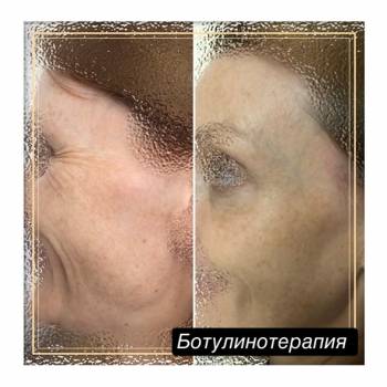 Фото с портфолио Юлия Баркова 