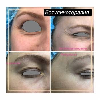 Фото с портфолио Юлия Баркова 