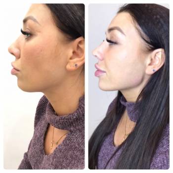 Карина Ерошенко , Харків Фото - 13