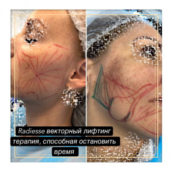 Фото с портфолио Юлия Баркова 