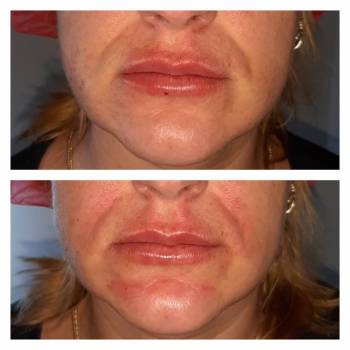 Алина Домашенко , Київ Фото - 13