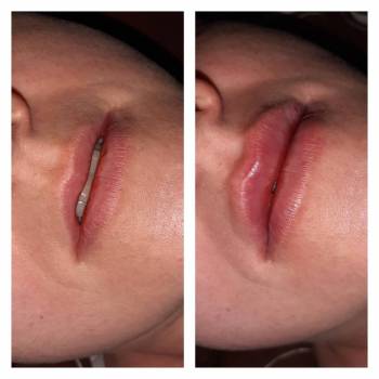 Алина Домашенко , Київ Фото - 12