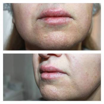 Алина Домашенко , Київ Фото - 4