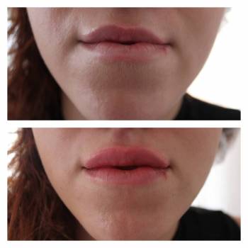 Алина Домашенко , Київ Фото - 3