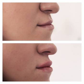 Алина Домашенко , Київ Фото - 20