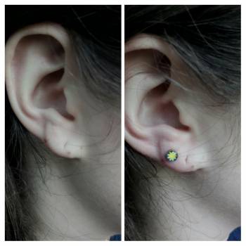 Дівчина 20 років

    