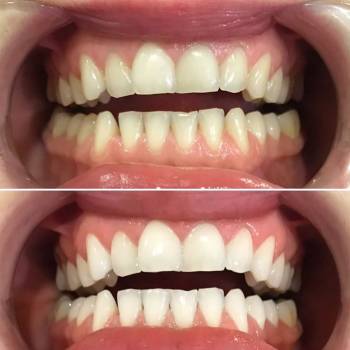 Smile Bar, Львів Фото - 5