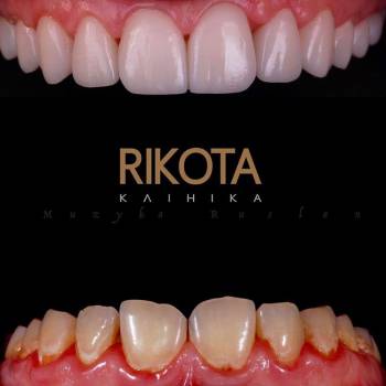 Rikota, Львів Фото - 5