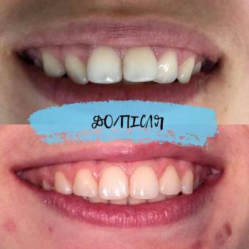 Пломбир, Київ Фото - 5