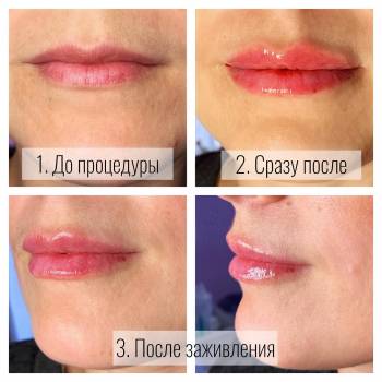 Юлия Юхименко, Кривой Рог Фото - 21