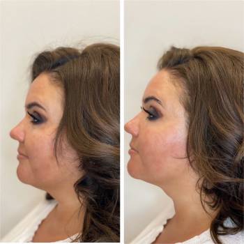 Imbir studio, Одесса Фото - 47