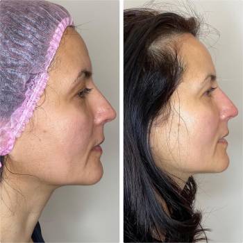 Imbir studio, Одесса Фото - 73