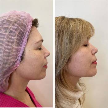 Imbir studio, Одесса Фото - 11