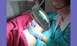 Электроэпиляция Майстер депіляції Оксана Запоріжжя
