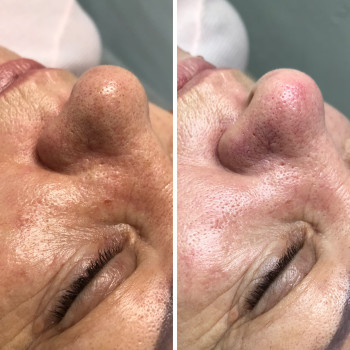 Фото с портфолио Екатерина Суворова 