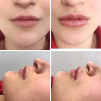 Фото с портфолио Екатерина Суворова 