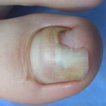 Фото с портфолио Центр подологии Аревик Ашигянц