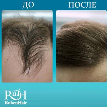 Фото с портфолио Ruben Hair