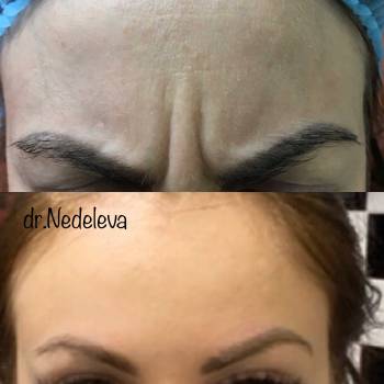 Алёна Неделева, Миколаїв Фото - 68