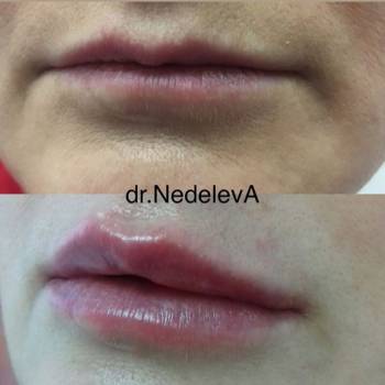 Алёна Неделева, Миколаїв Фото - 70