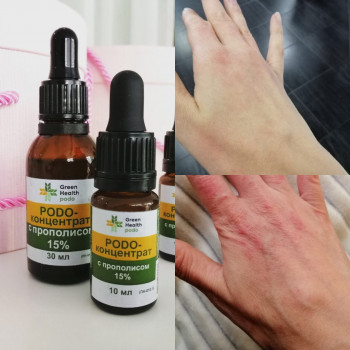 Зачистка/лечение онихолизиса
                    СПА-салон Green Health Одесса