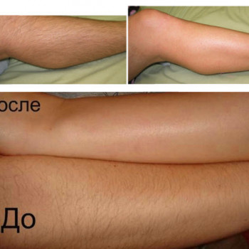 Шугаринг (женский) ноги до колен
                    СПА-салон Green Health Одесса