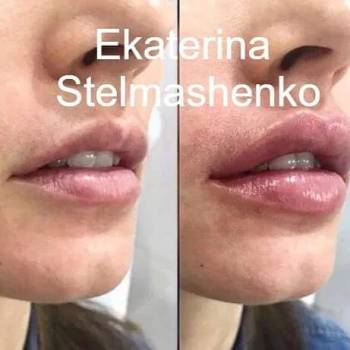 Фото с портфолио Екатерина Стельмашенко