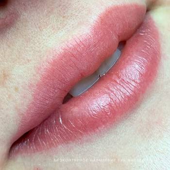 Збільшення губ, фото - Салон краси Beauty Place by Anna Schastlivaya