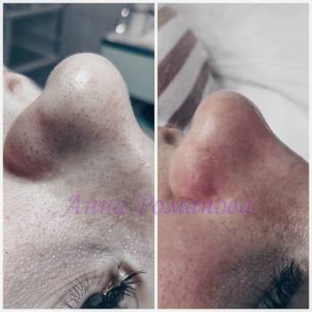 Фото с портфолио Beauty RomAnna