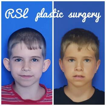 Отопластика
