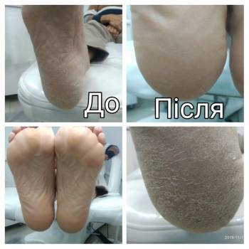 Новодерм, Львов Фото - 6