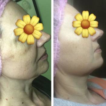 Фото с портфолио Ольга Журжа 