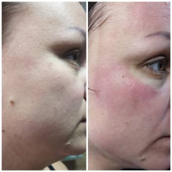 Анна Гарич Гарич, Днепр Фото - 6