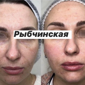 полинуклеотиды
