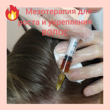 Мезотерапия волосистой части головы
                    Косметолог Дарья Одеса