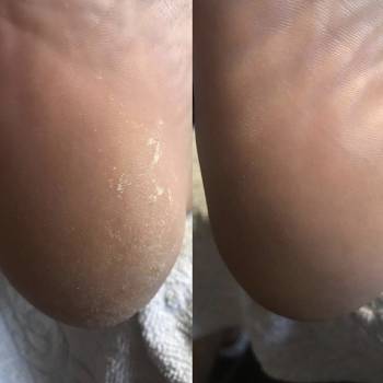 Алина , Ужгород Фото - 16