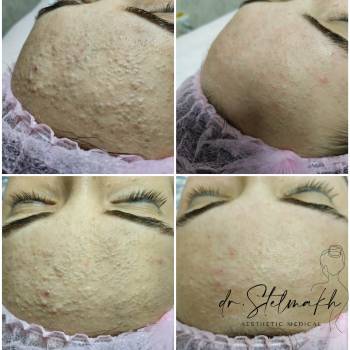 Фото с портфолио Екатерина Стельмах