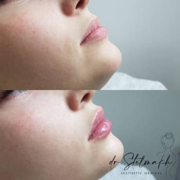 Фото с портфолио Екатерина Стельмах