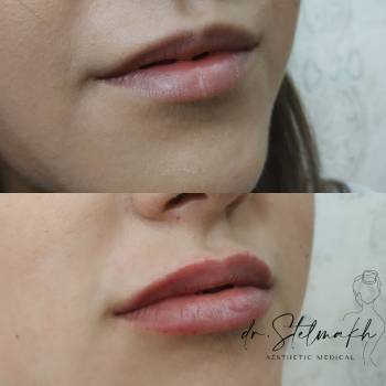 Фото с портфолио Екатерина Стельмах